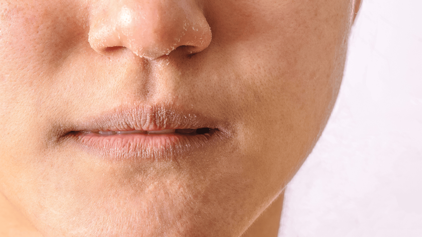 mujer con los labios secos